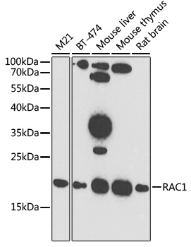 RAC1 Antibody