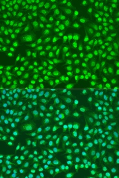 PSEN2 Antibody