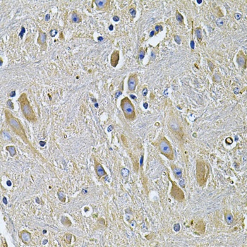 PLCG1 Antibody