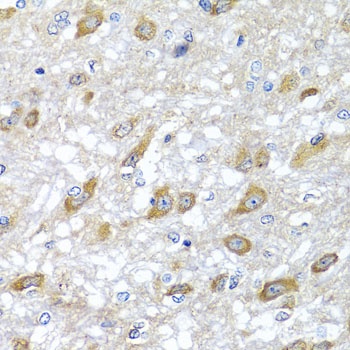 HSPA6 Antibody