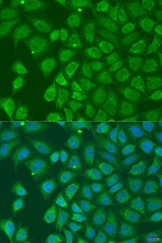 HOXD10 Antibody
