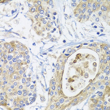 GSTA2 Antibody