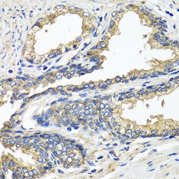 ETFA Antibody