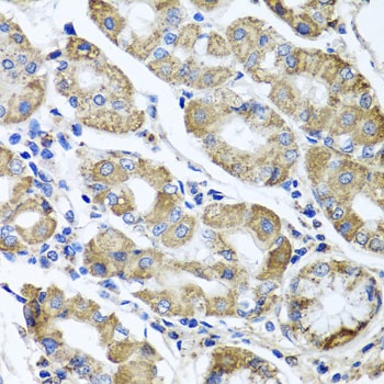 ETFA Antibody