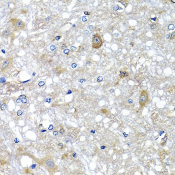 ETFA Antibody