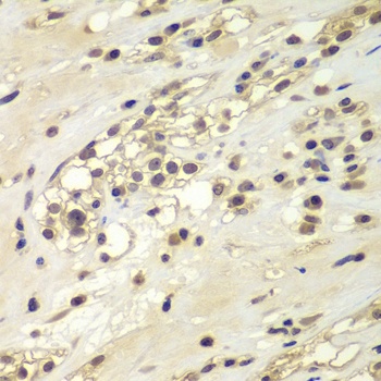 CHEK1 Antibody
