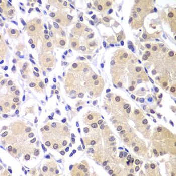 CHEK1 Antibody
