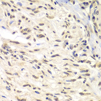 CHEK1 Antibody