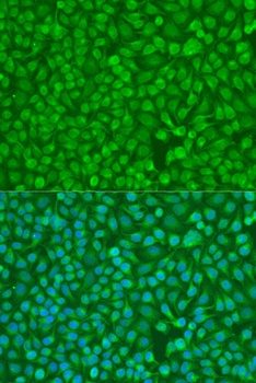 CHEK1 Antibody