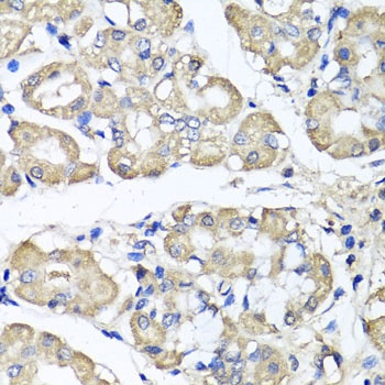 BCS1L Antibody