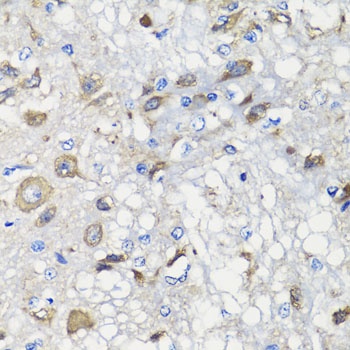 BCS1L Antibody