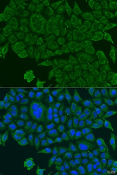 BCS1L Antibody