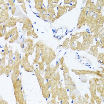 GLUT4 Antibody