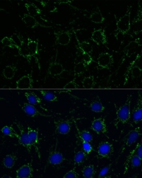 GLUD1 Antibody