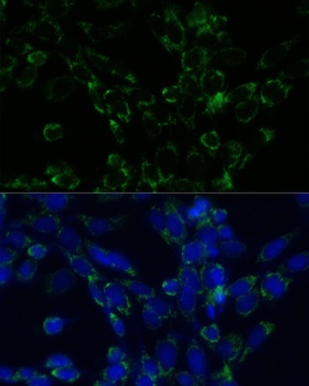 GLUD1 Antibody