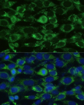 GLUD1 Antibody