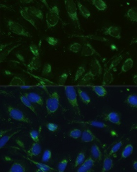 GLUD1 Antibody