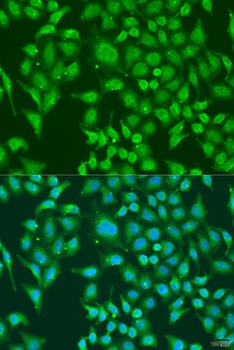 CENPQ Antibody