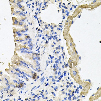 MYH7 Antibody