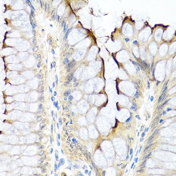 INHBC Antibody