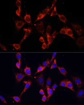 DVL2 Antibody