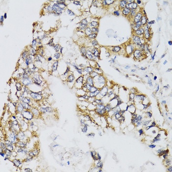 CHN1 Antibody