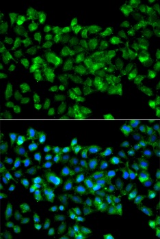 CBR3 Antibody