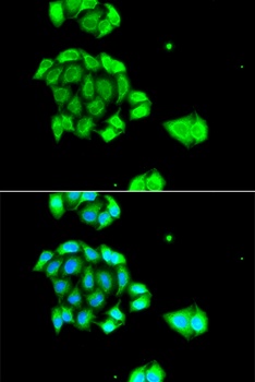 Rad51D Antibody