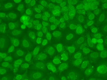 TARBP2 Antibody
