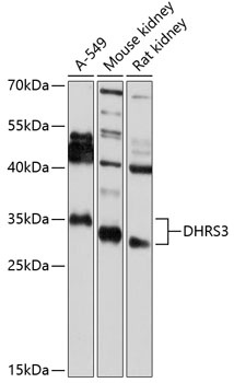 DHRS3 Antibody