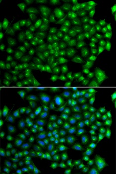 ZFYVE1 Antibody