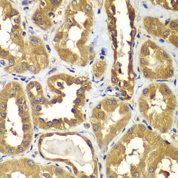 RAB1B Antibody