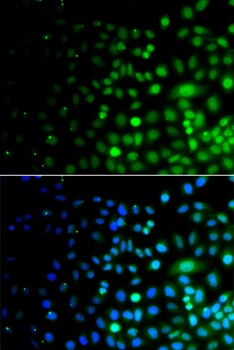 UBA6 Antibody