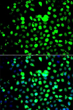 ZBTB25 Antibody