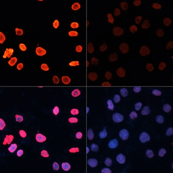 HNRNPA1 Antibody