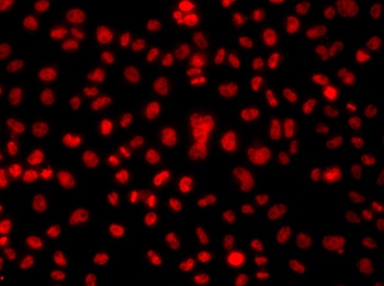 HNRNPA1 Antibody