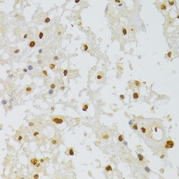 HNRNPA1 Antibody