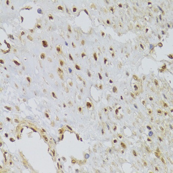 HNRNPA1 Antibody