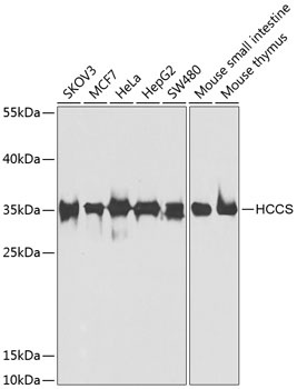 HCCS Antibody