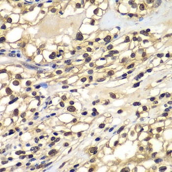 ZNF169 Antibody