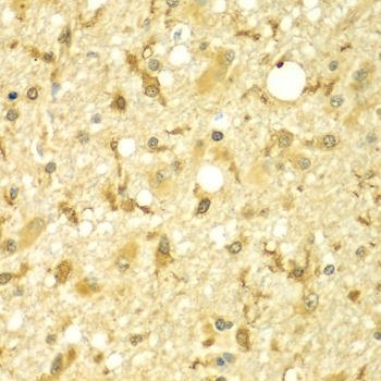 SPAG16 Antibody