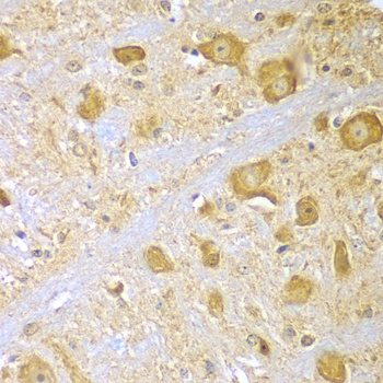 SPAG16 Antibody