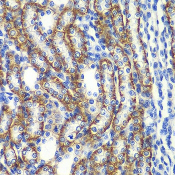 ZFAND3 Antibody