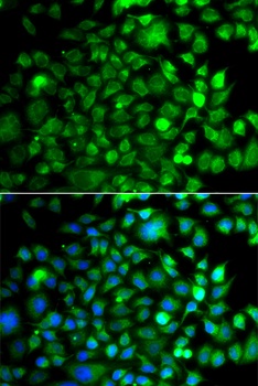 OSGEP Antibody