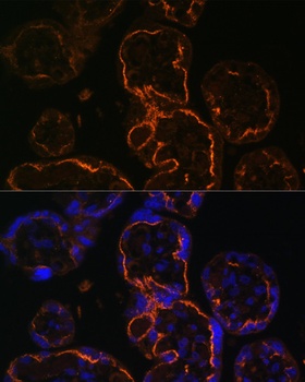 LDB3 Antibody