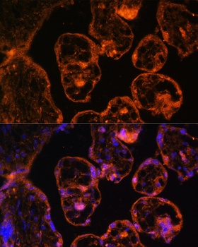 LDB3 Antibody