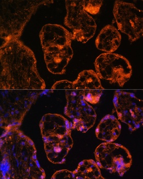 LDB3 Antibody