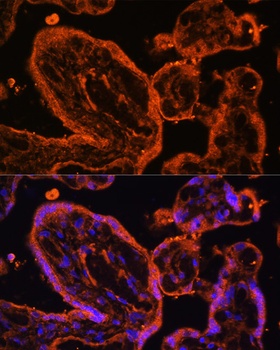 LDB3 Antibody