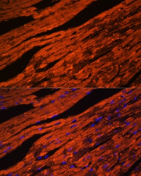 LDB3 Antibody