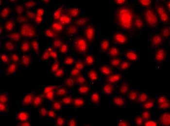 TEAD3 Antibody